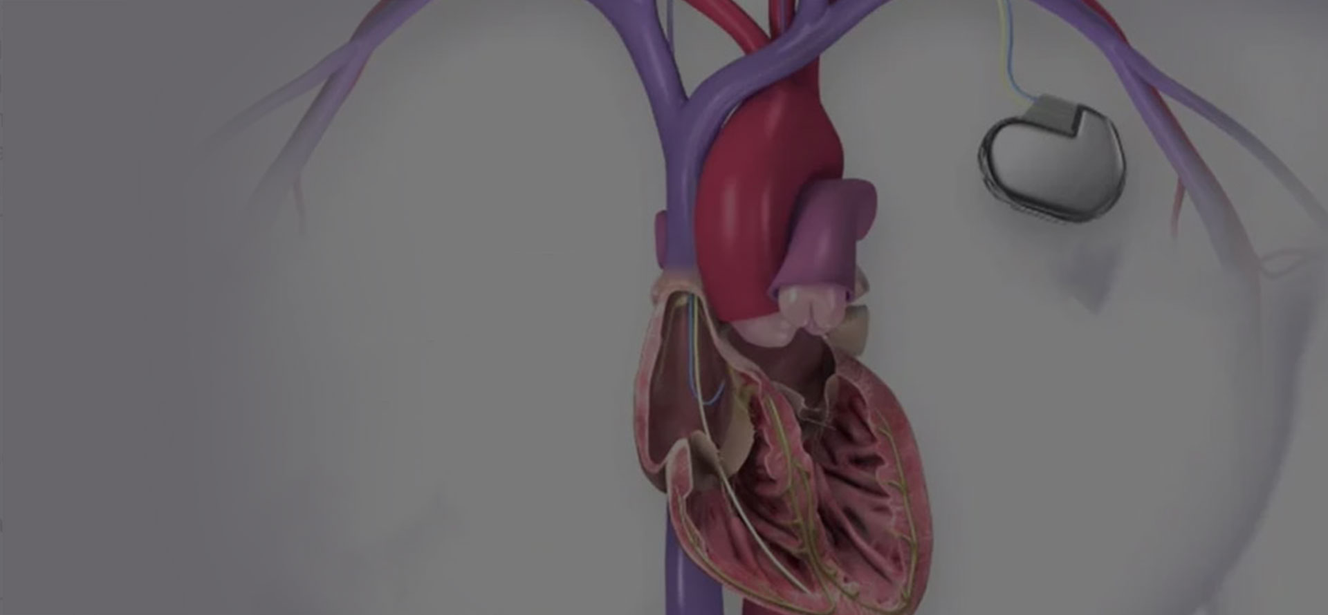 Cardiology & Electrophysiology Specialist - The Summerfield - LEESBURG Leesburg - FL